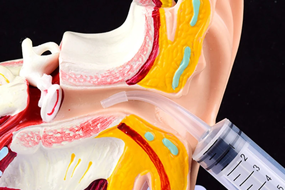 Kulak Lavajı: İşlem ve Önemli Bilgiler